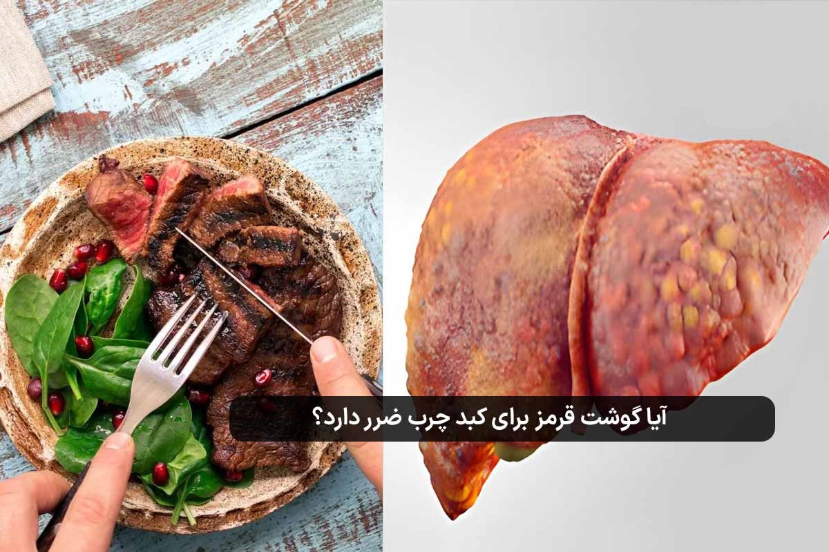 تاثیر گوشت سرخ‌شده بر کبد چرب غیرالکلی (NAFLD)