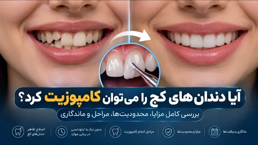 آیا دندان‌های کج را می‌توان کامپوزیت کرد؟ بررسی کامپوزیت دندان کج قبل از تصمیم‌گیری
